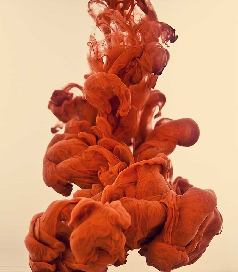آلبرتو سوسو (Alberto Seveso)
